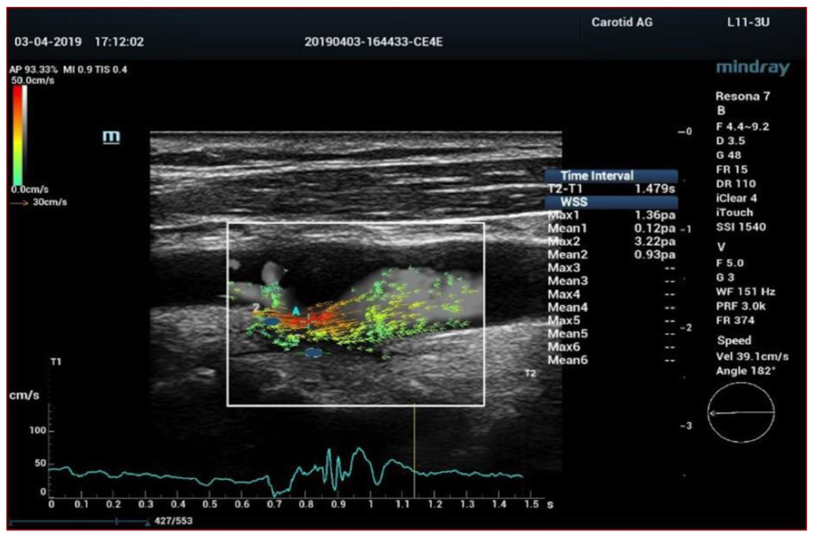 Diagnostics 13 01478 g006