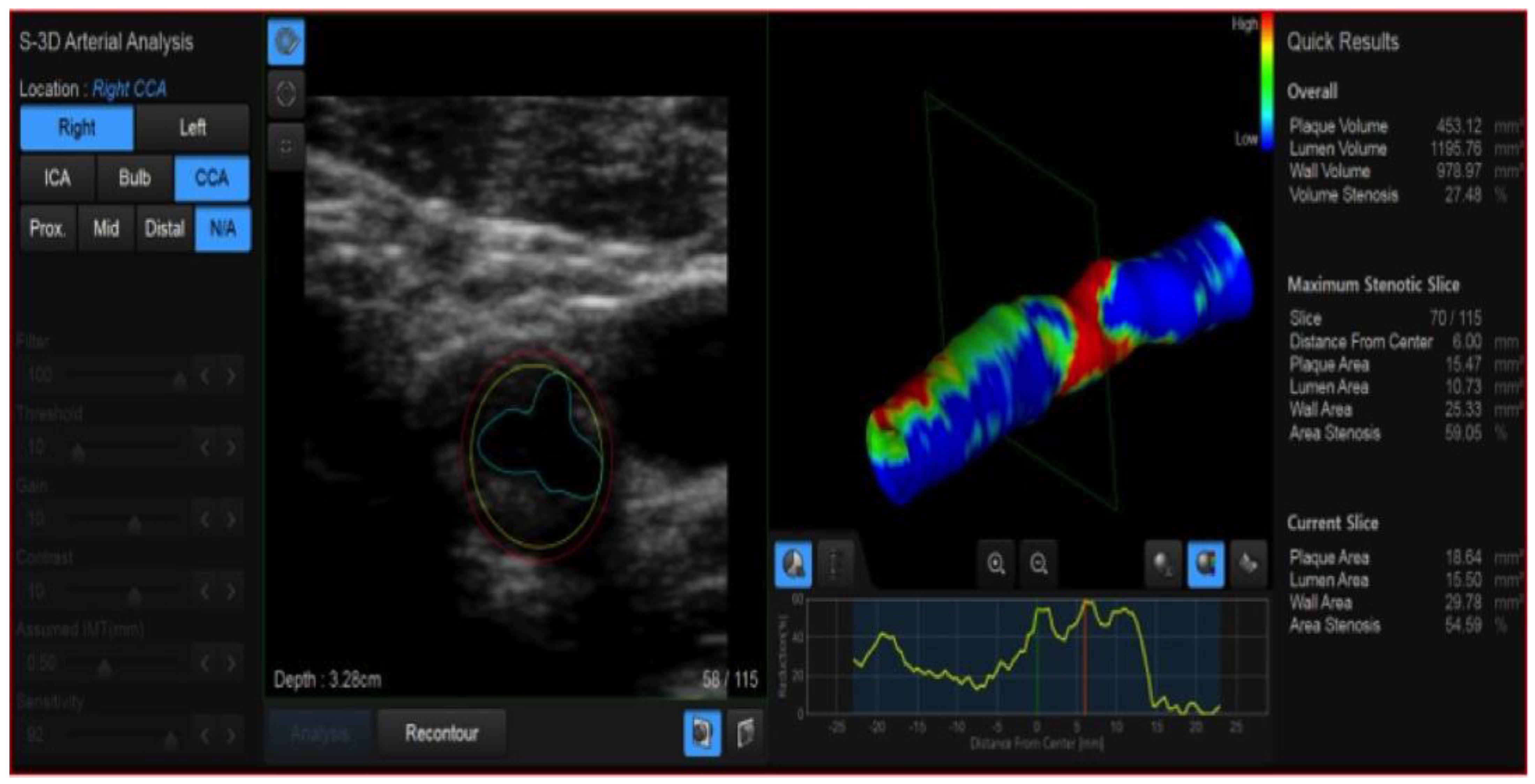 Diagnostics 13 01478 g007