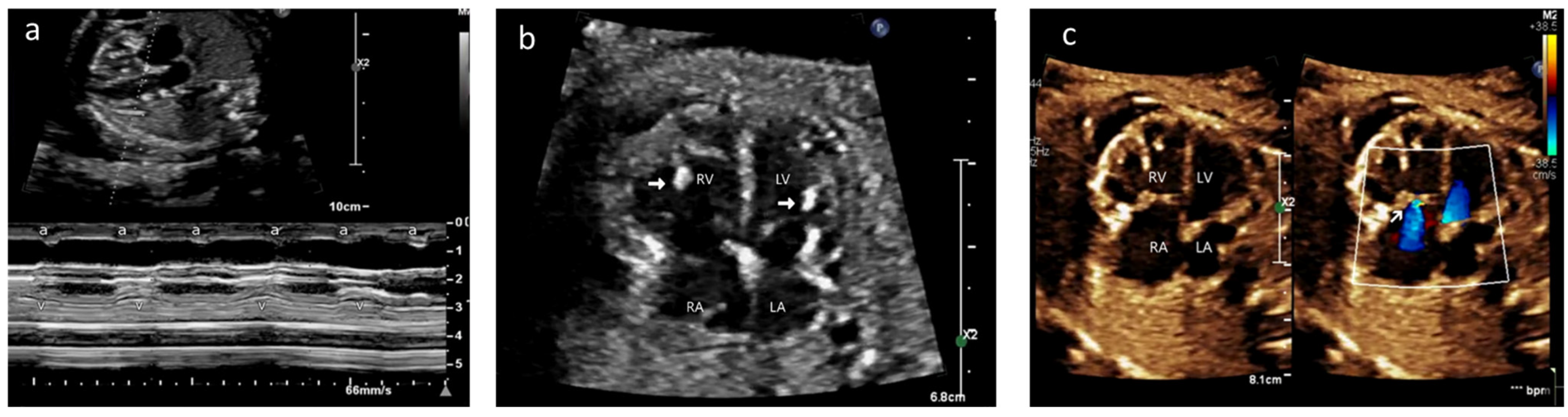 Diagnostics 13 01481 g001