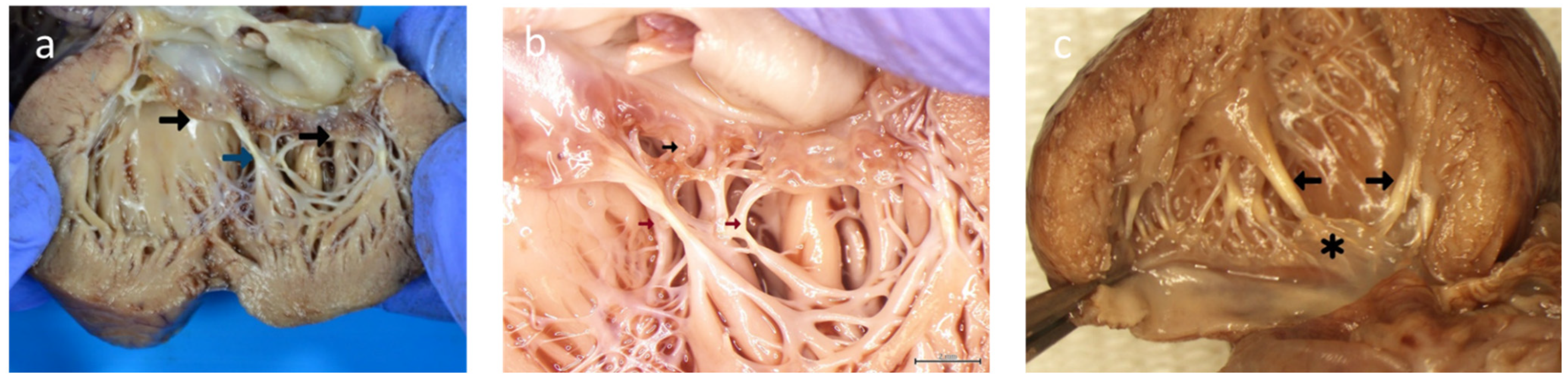 Diagnostics 13 01481 g006