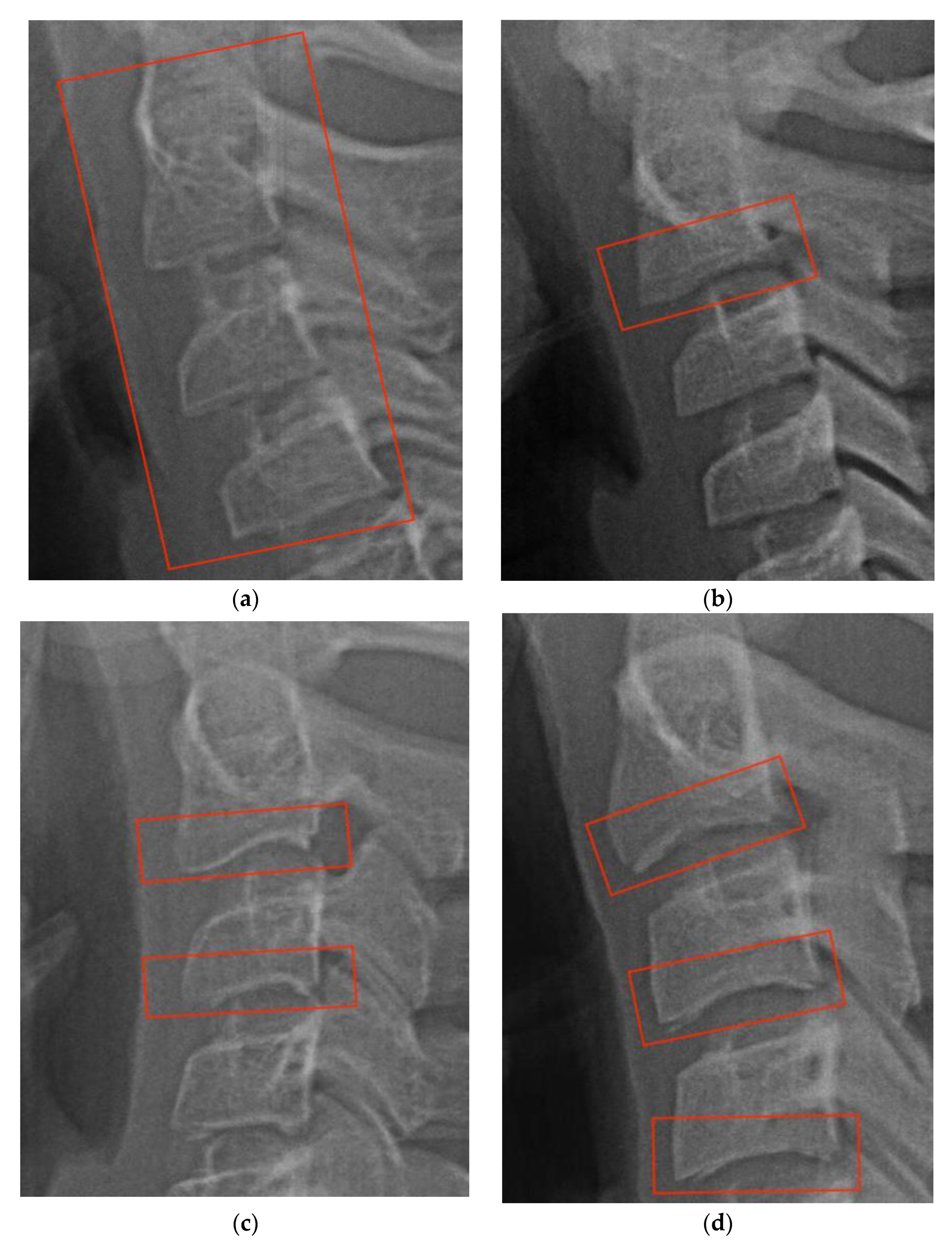 Diagnostics 13 01485 g002