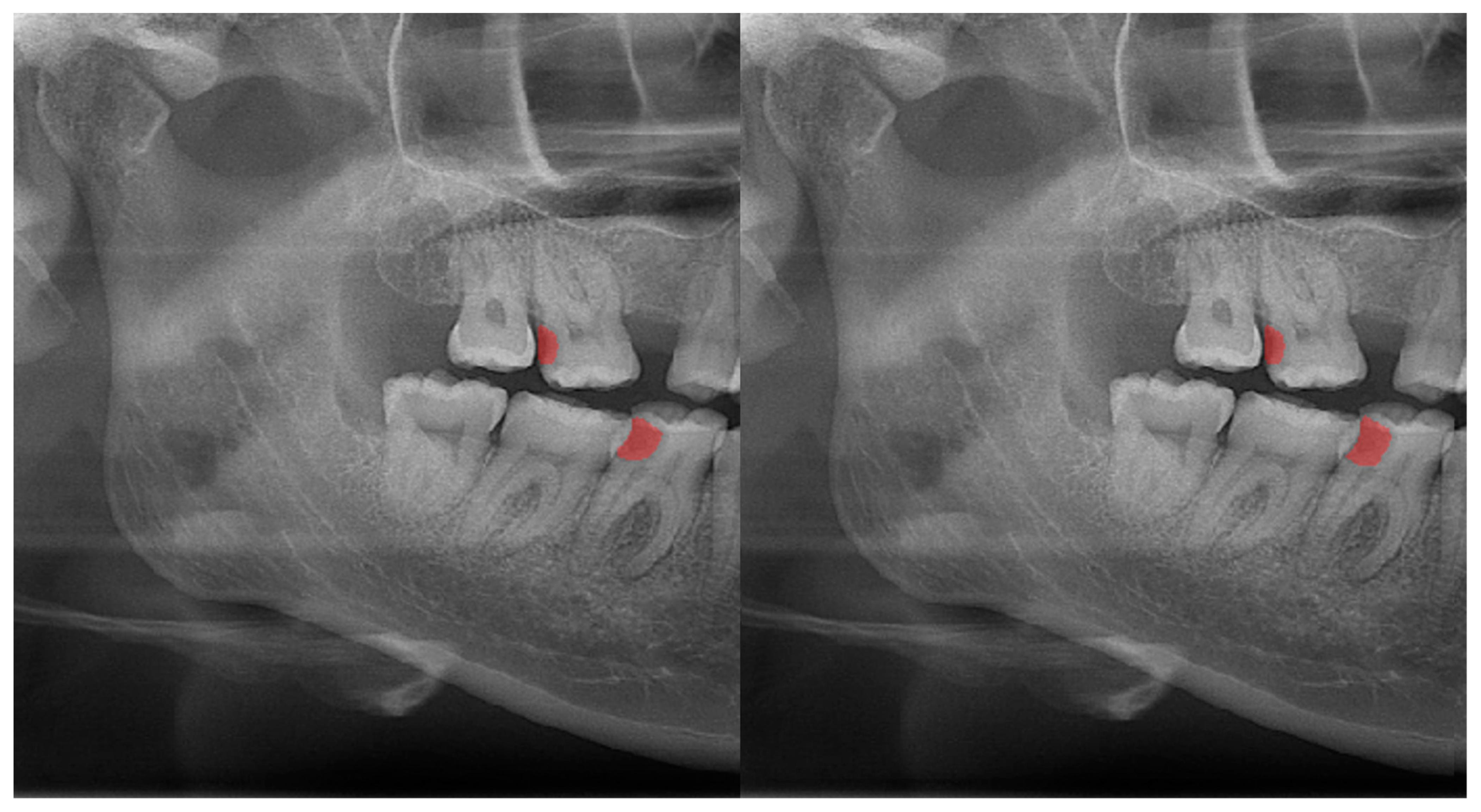 Diagnostics 13 01487 g003
