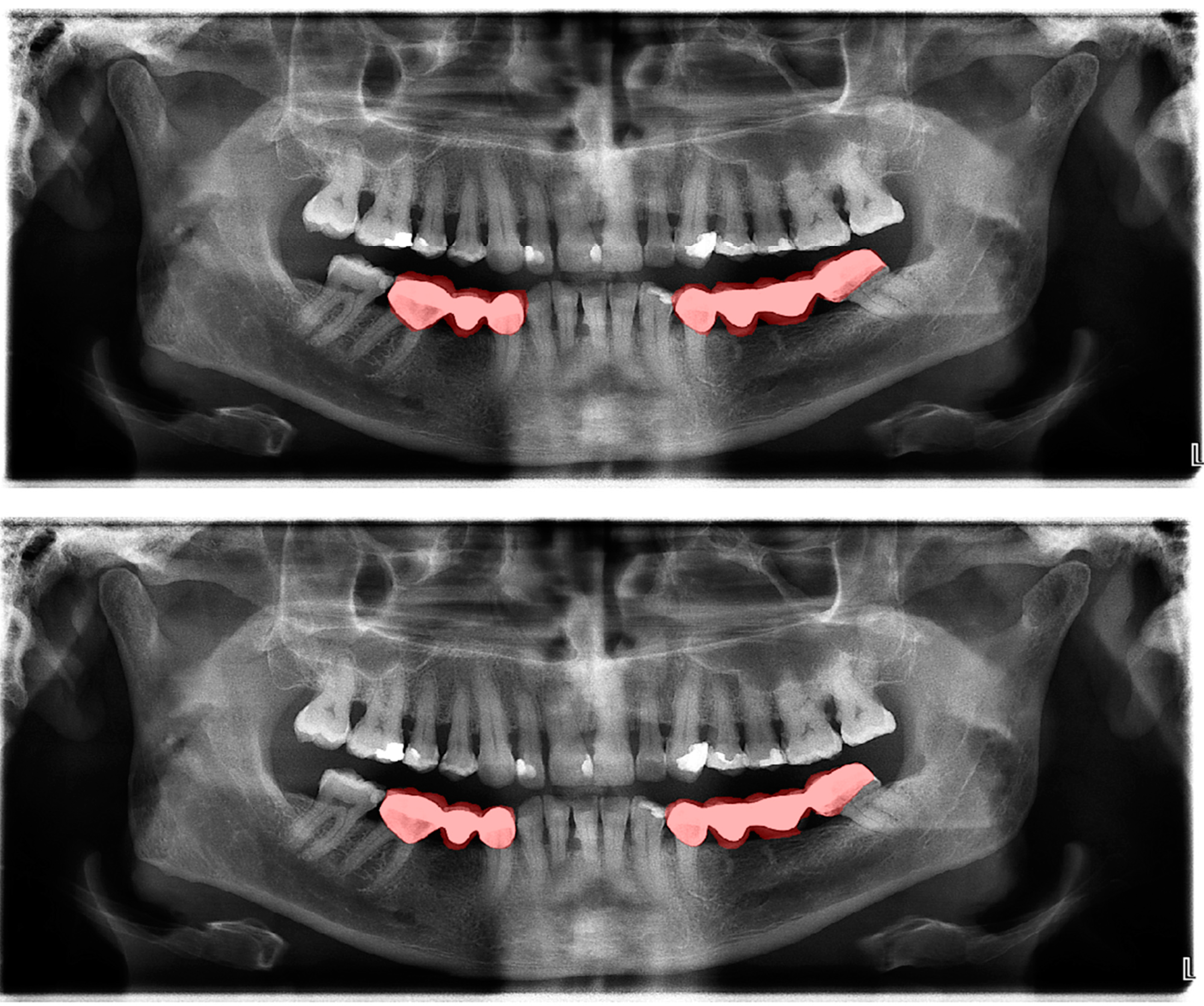 Diagnostics 13 01487 g004