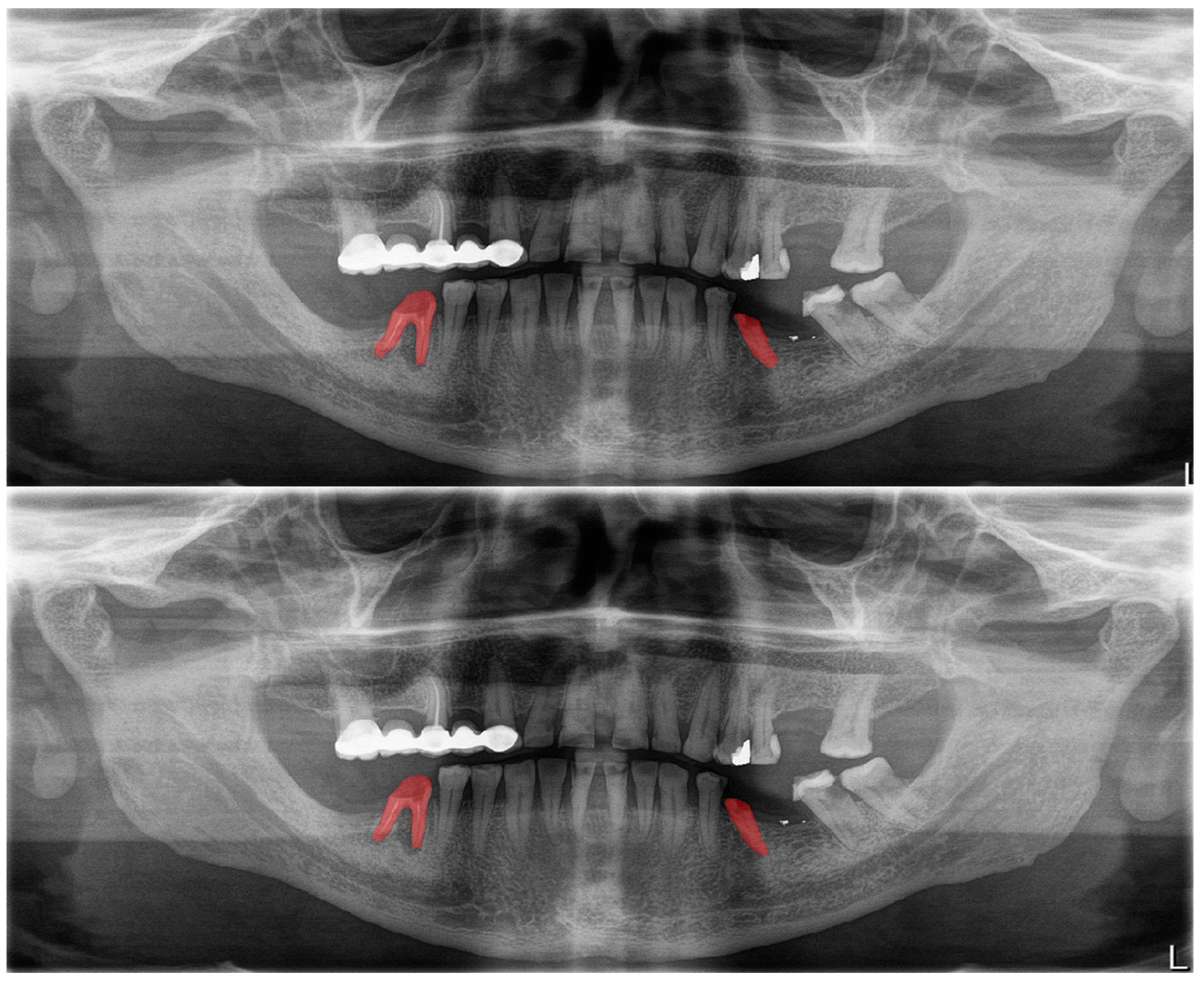 Diagnostics 13 01487 g007