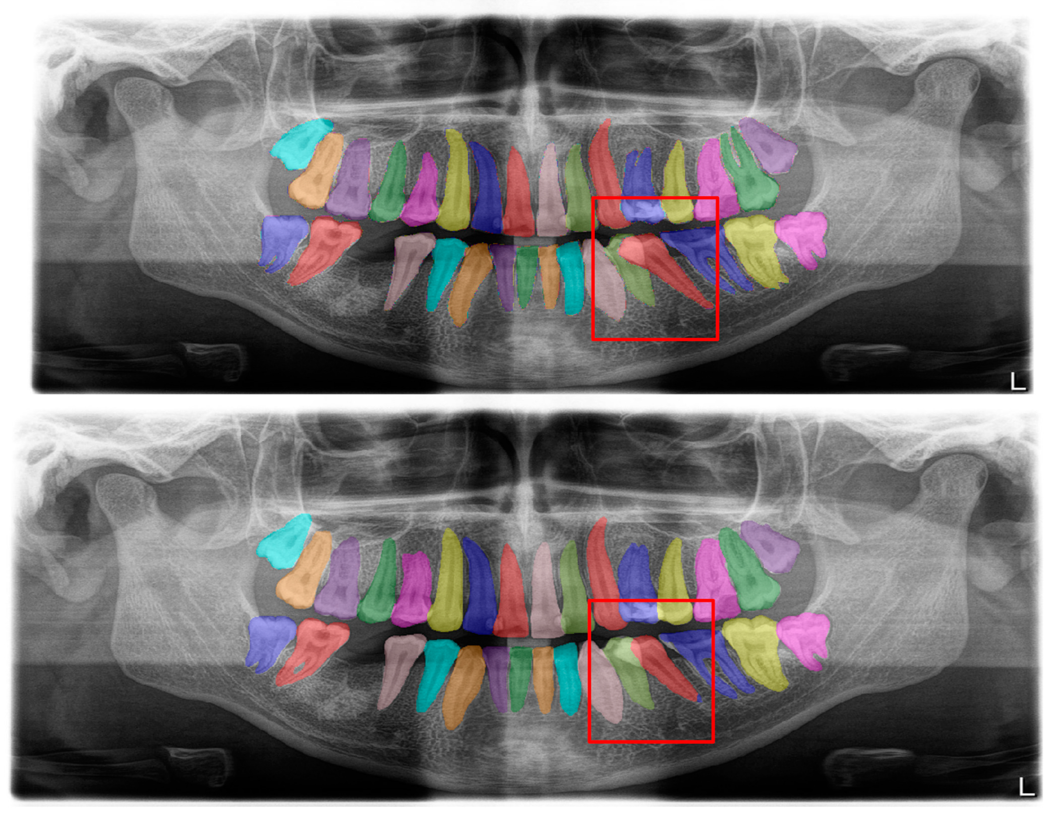 Diagnostics 13 01487 g009