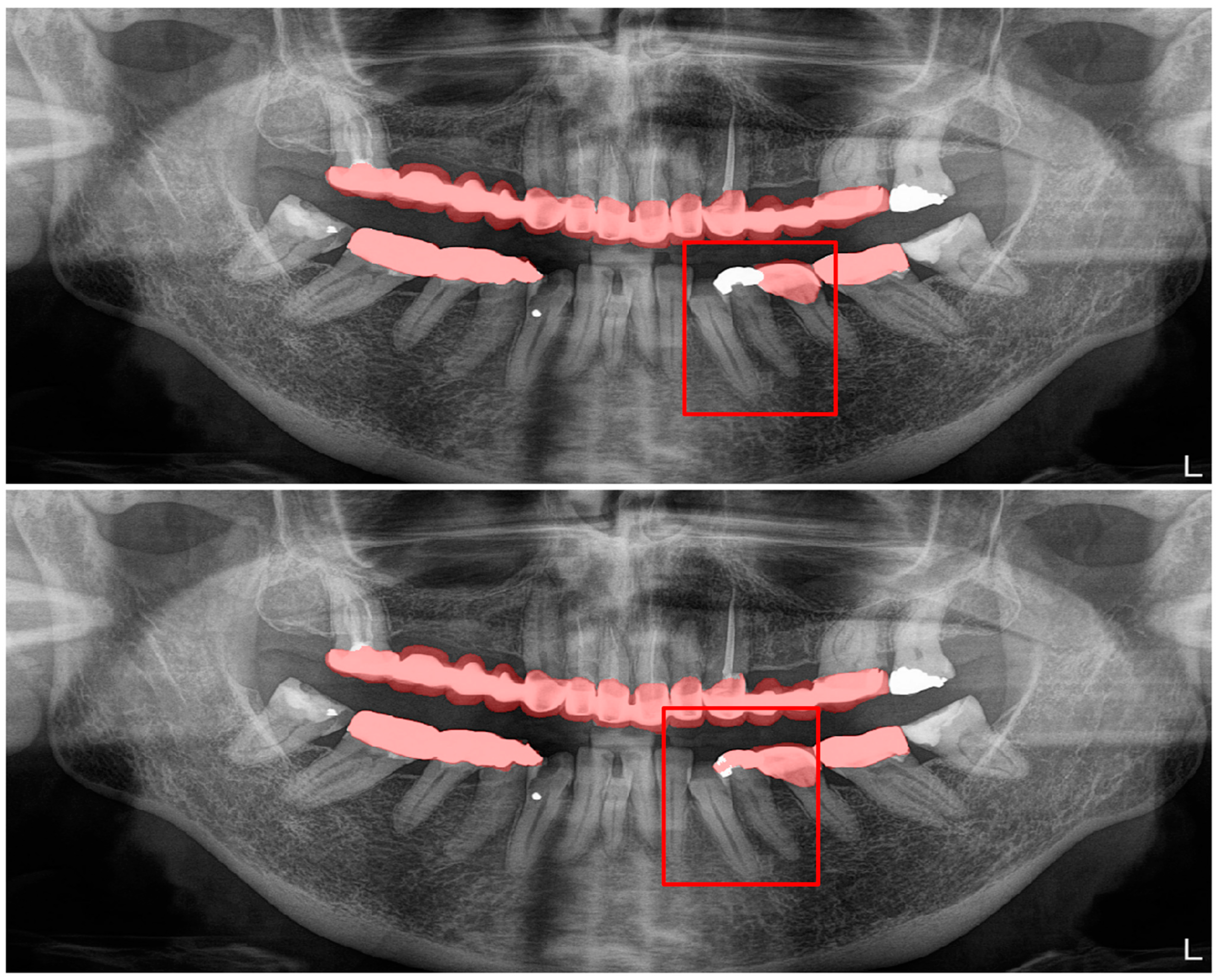 Diagnostics 13 01487 g010