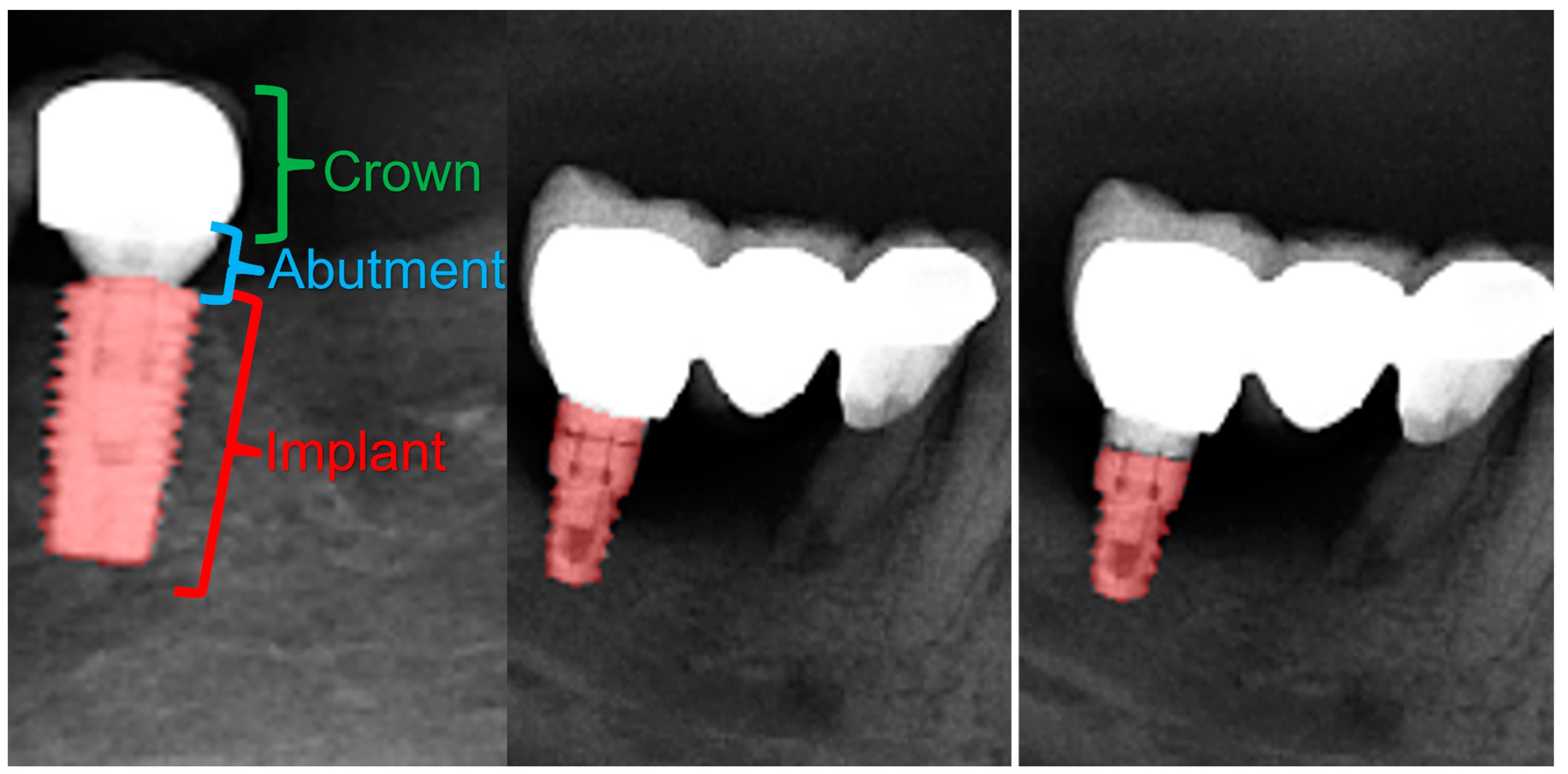 Diagnostics 13 01487 g011
