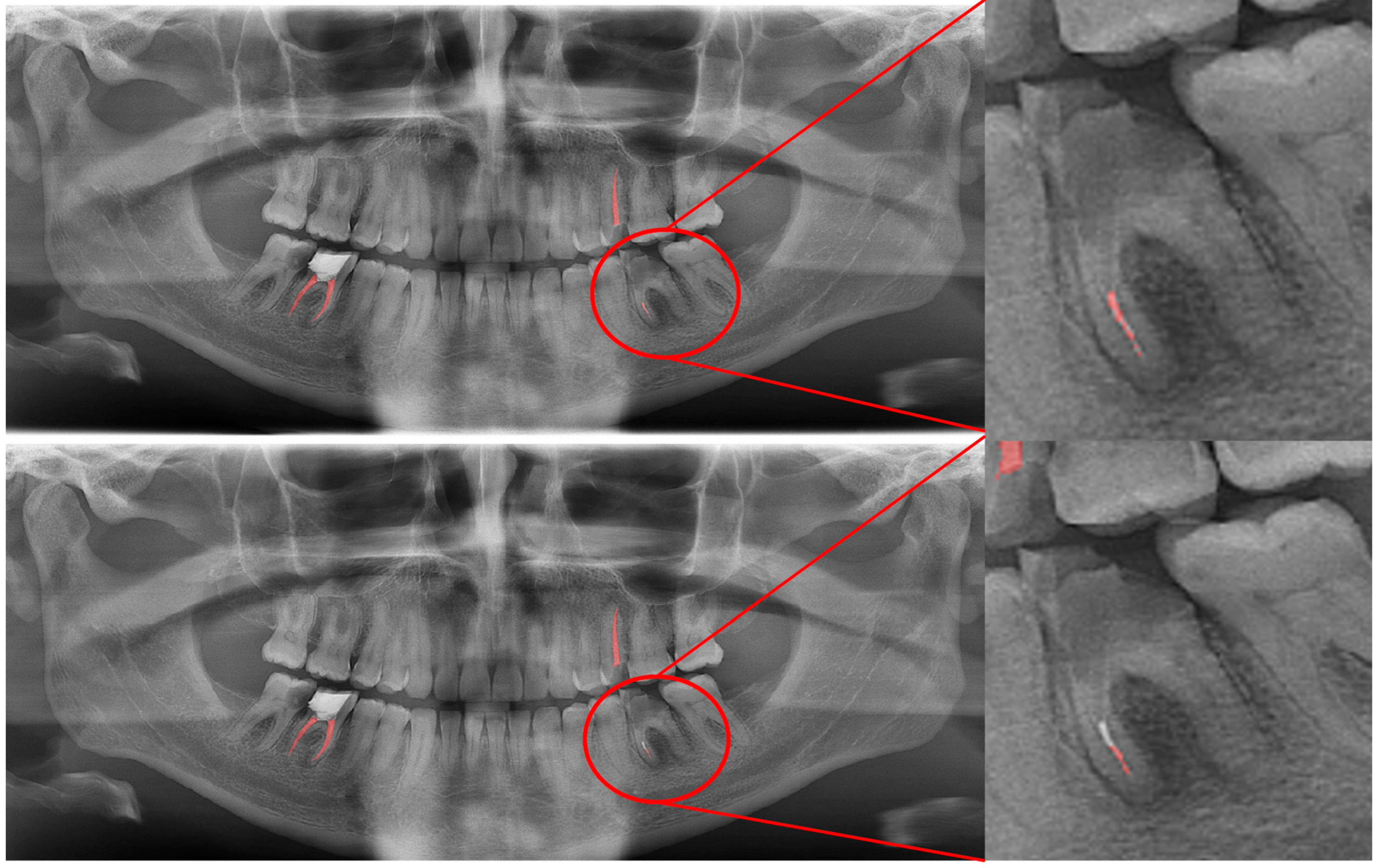 Diagnostics 13 01487 g012