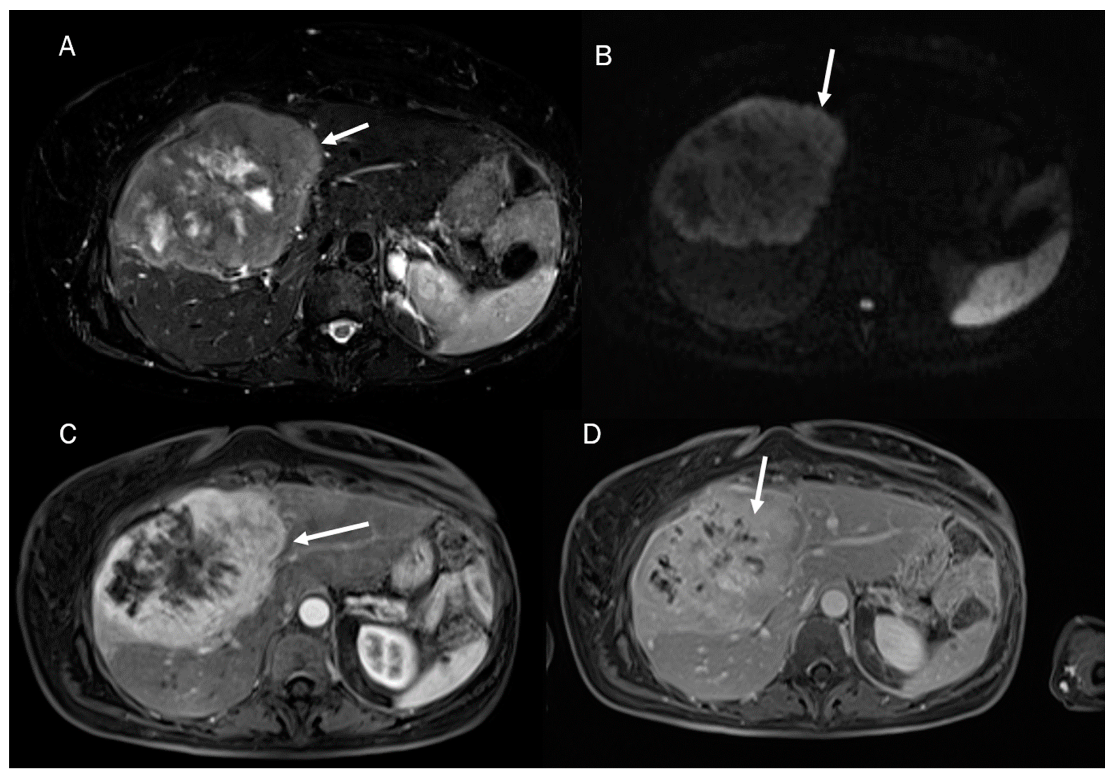 Diagnostics 13 01488 g001