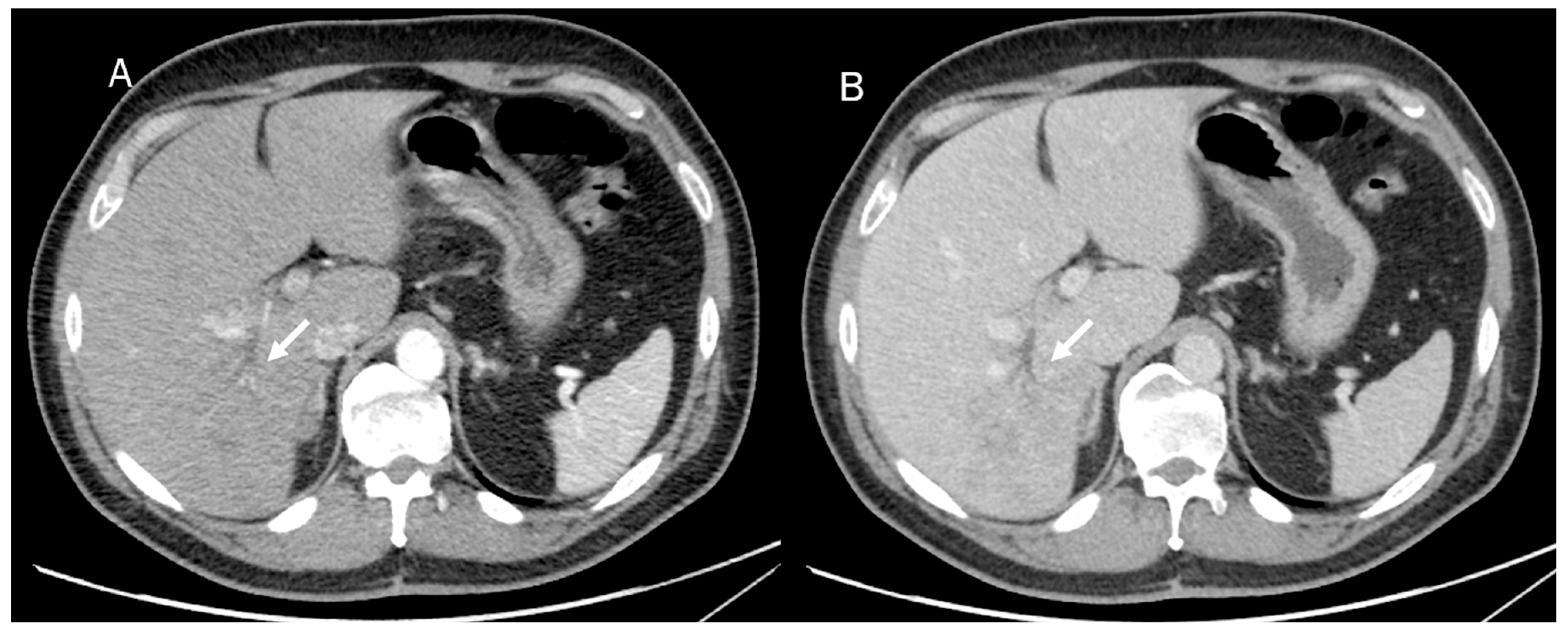 Diagnostics 13 01488 g004