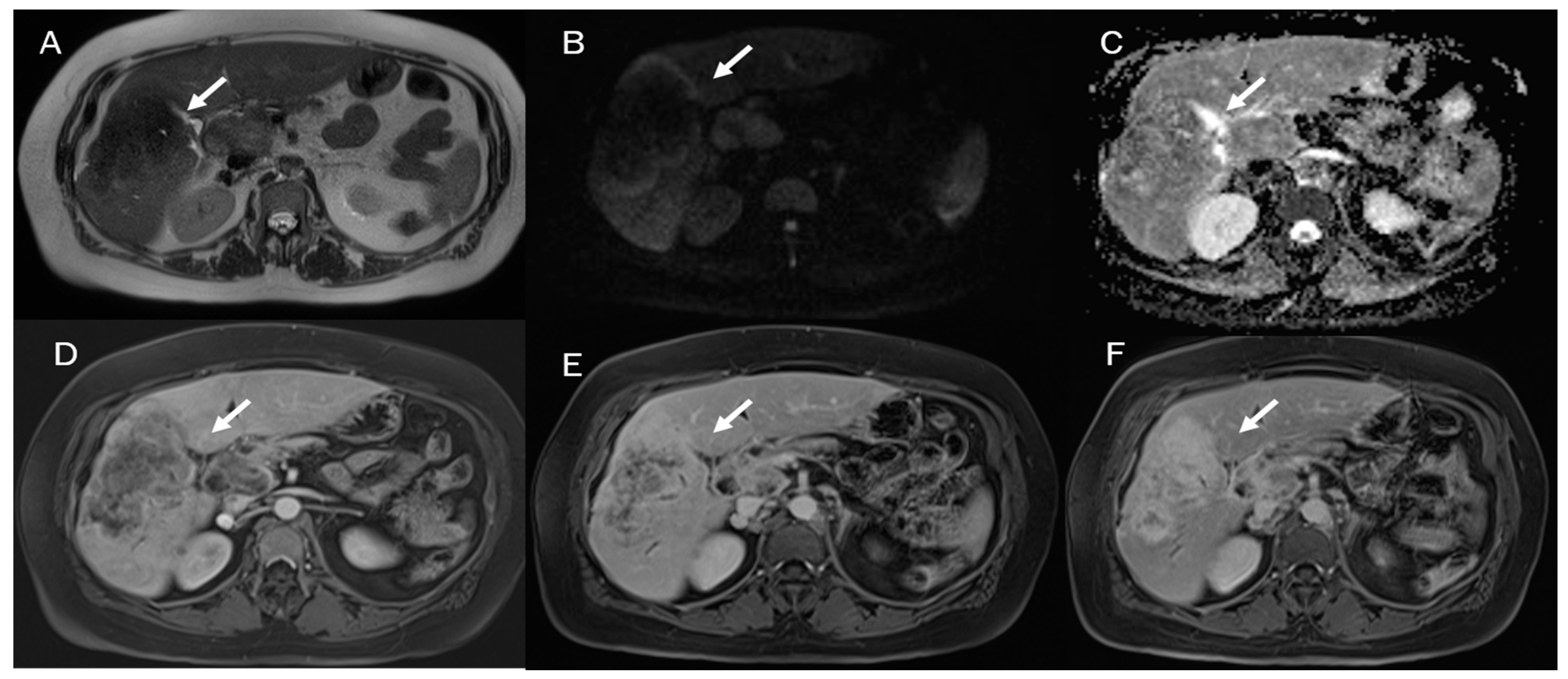 Diagnostics 13 01488 g005