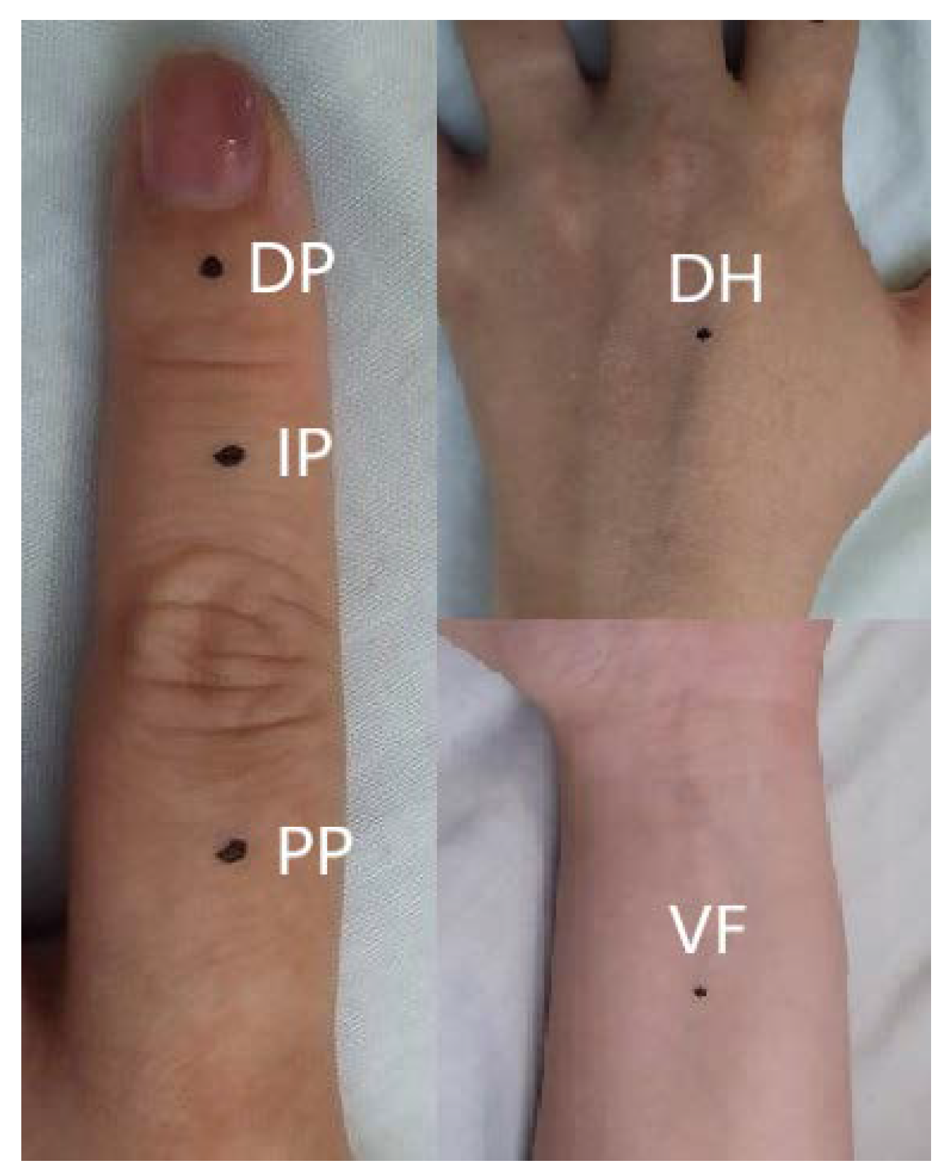 Diagnostics 13 01495 g001