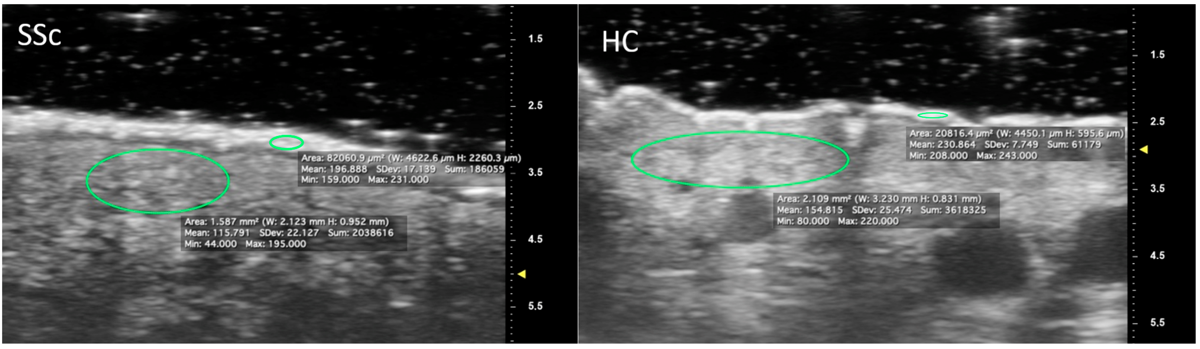 Diagnostics 13 01495 g003