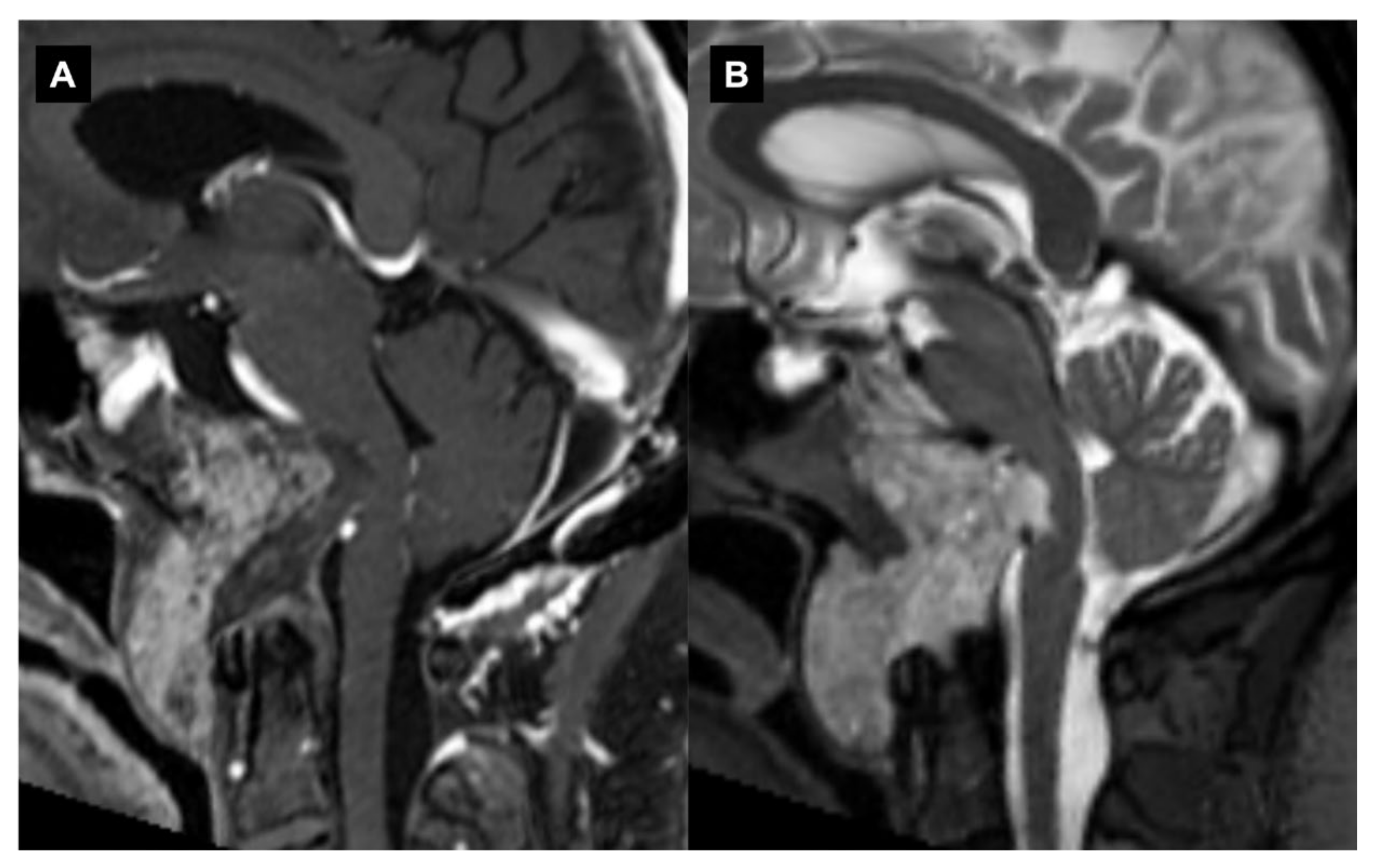 Diagnostics 13 01502 g001