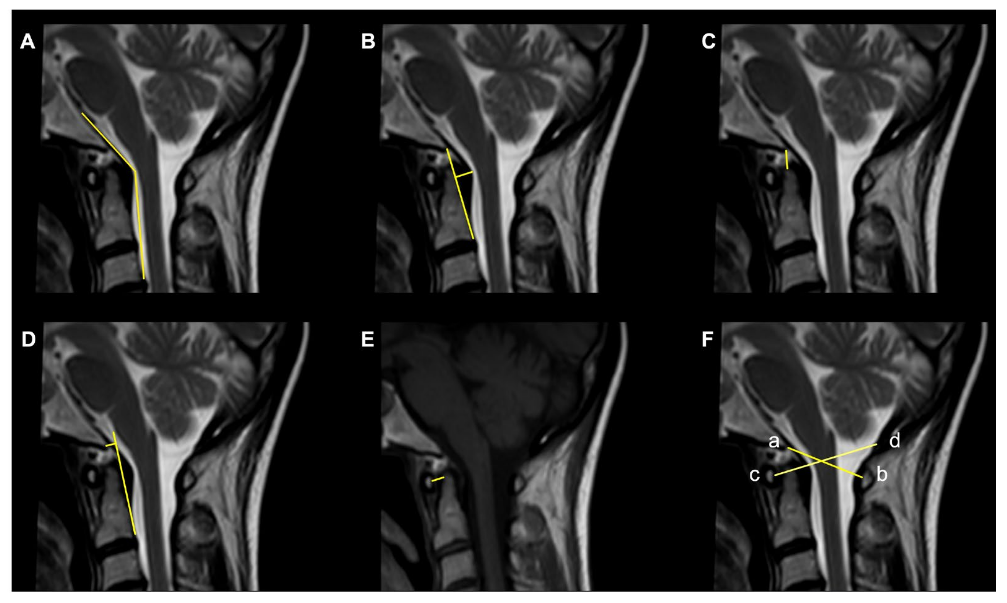 Diagnostics 13 01502 g003