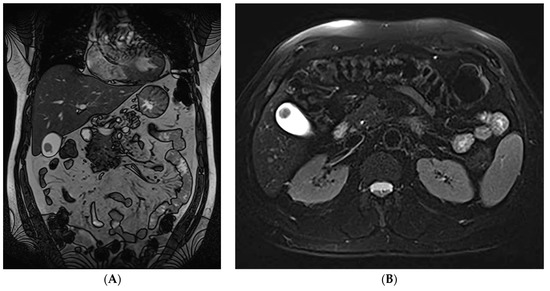 Diagnostics 13 01509 g001