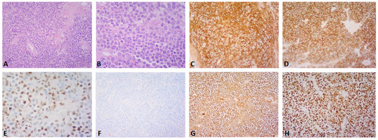 Diagnostics 13 01509 g002