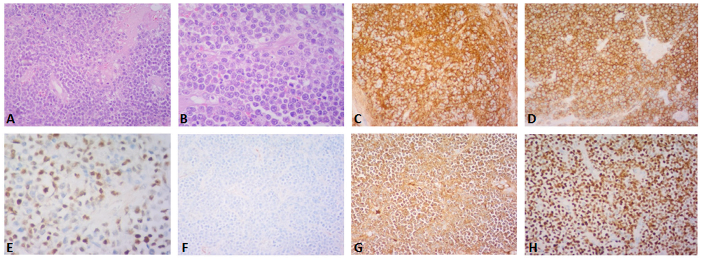 Diagnostics 13 01509 g002