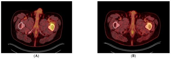 Diagnostics 13 01509 g003a