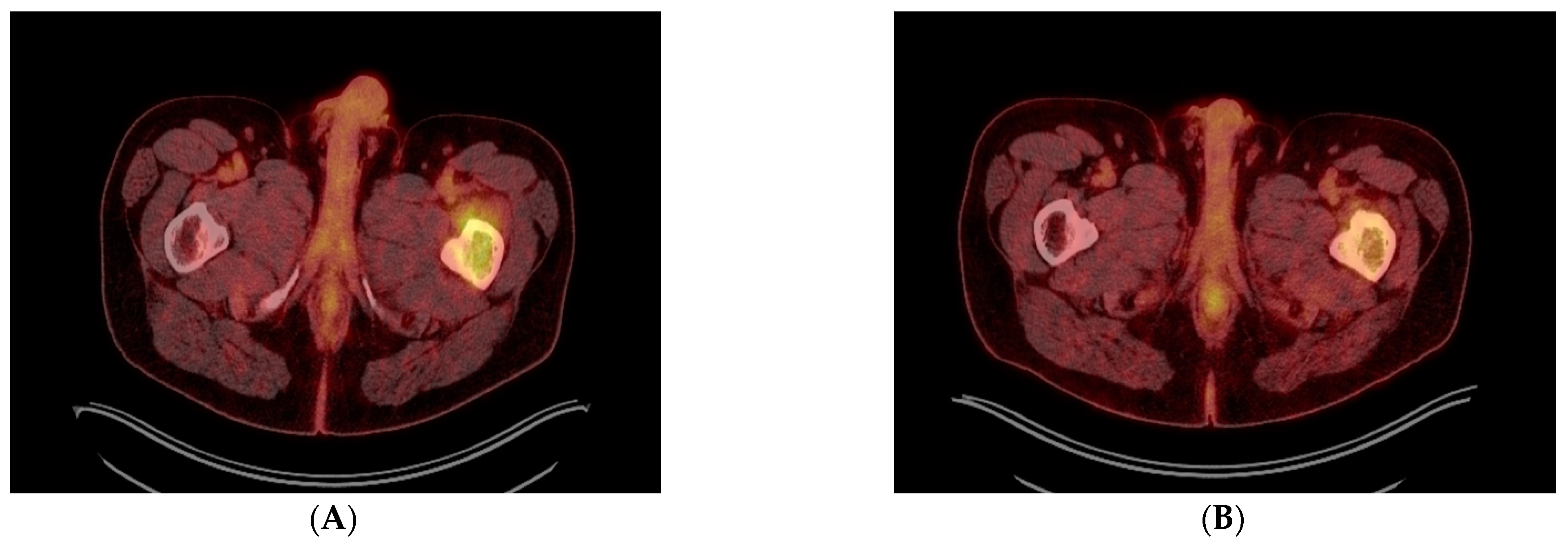 Diagnostics 13 01509 g003a