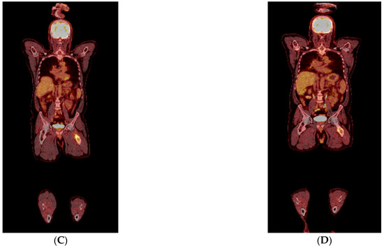 Diagnostics 13 01509 g003b