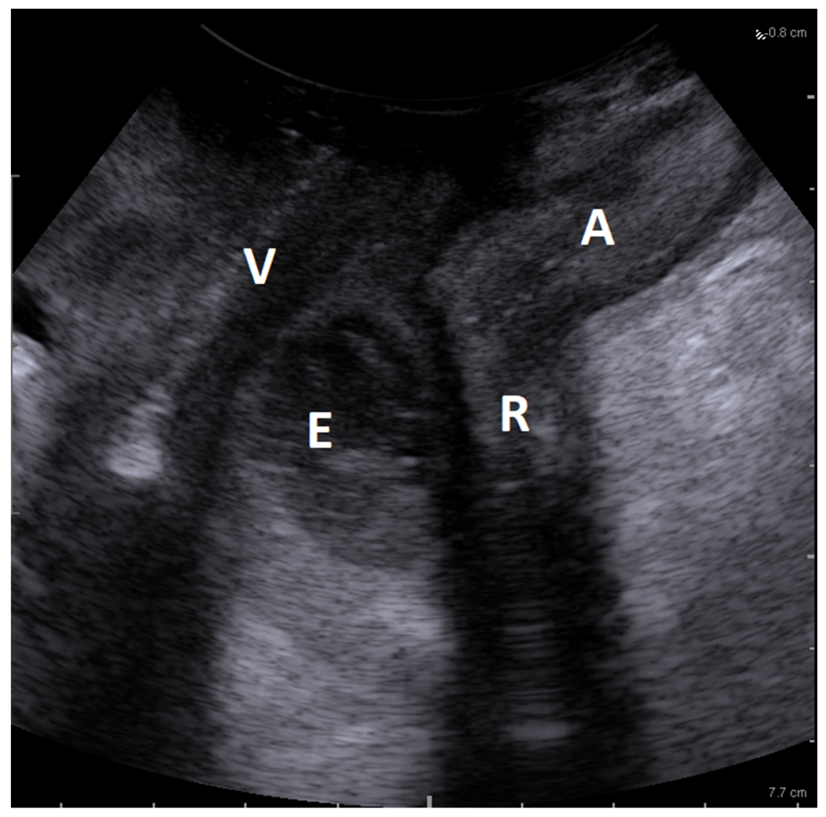 Diagnostics 13 01514 g001