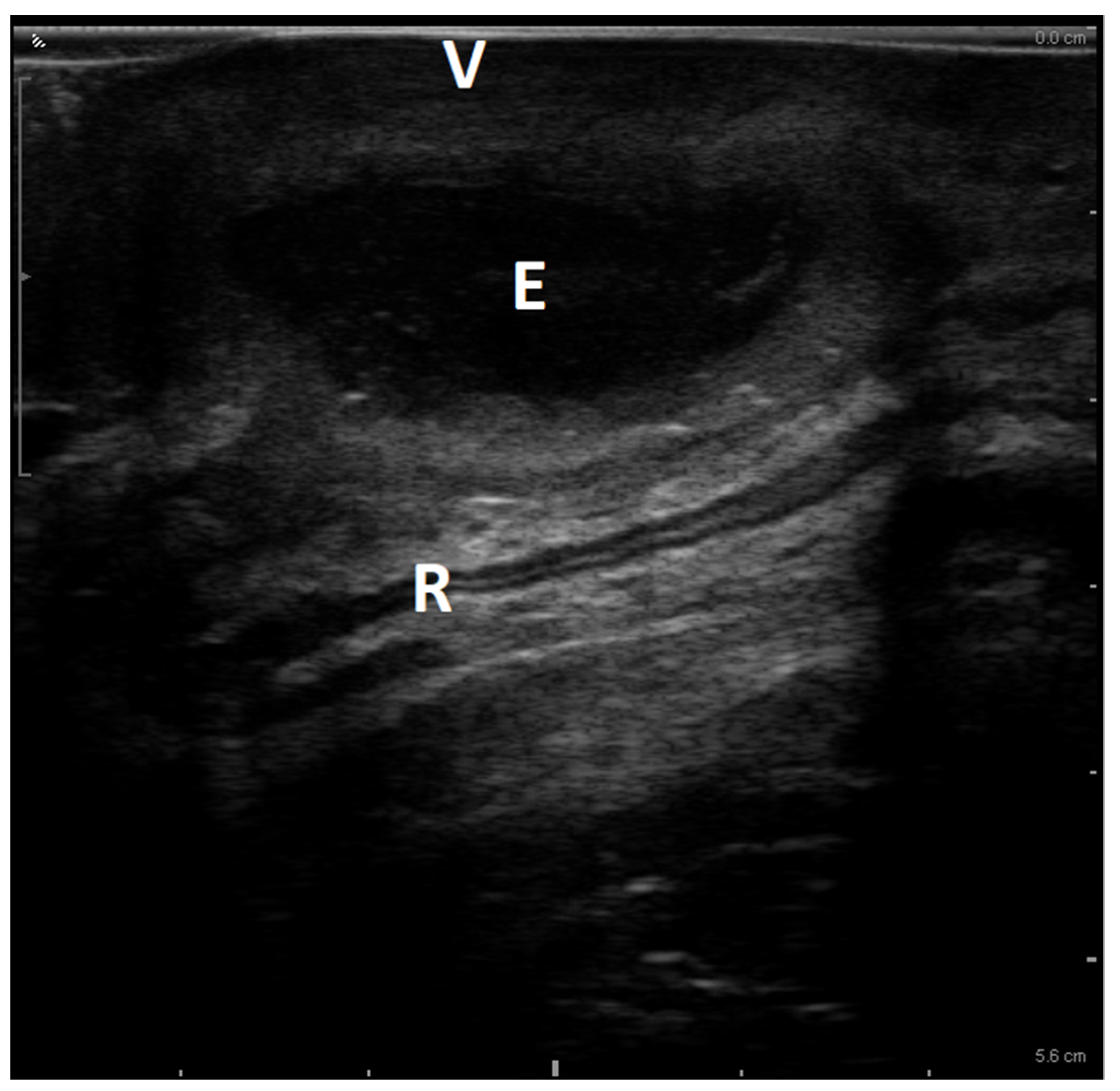 Diagnostics 13 01514 g003