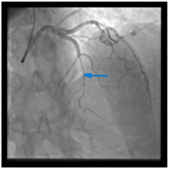 Diagnostics 13 01518 g001