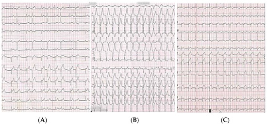 Diagnostics 13 01518 g002
