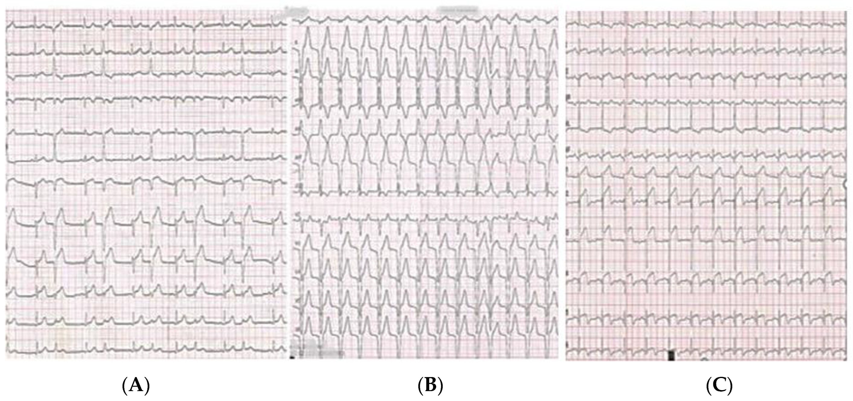 Diagnostics 13 01518 g002