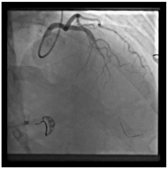 Diagnostics 13 01518 g003