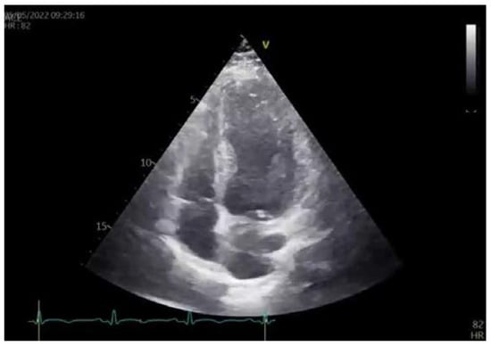 Diagnostics 13 01518 g004