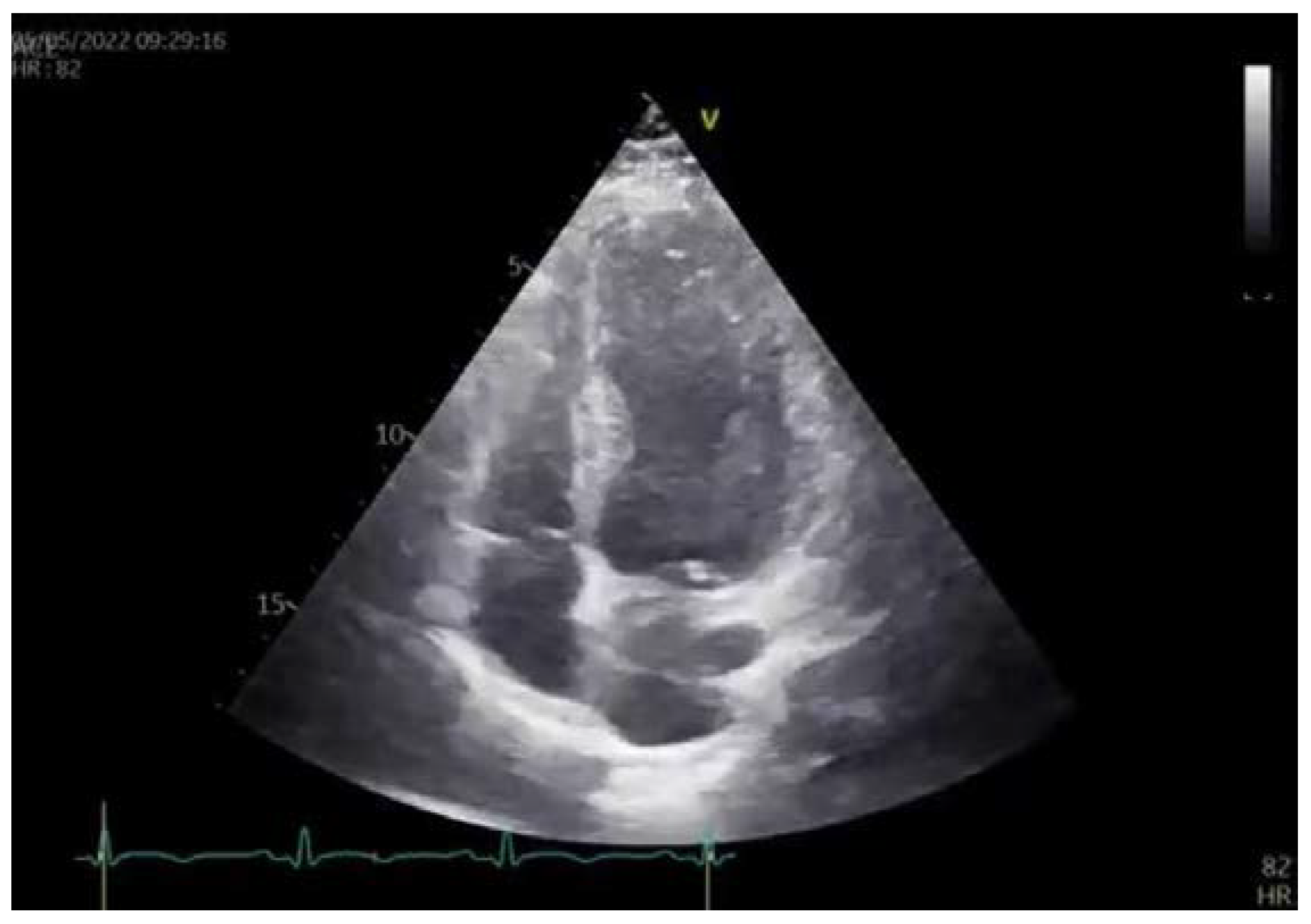 Diagnostics 13 01518 g004