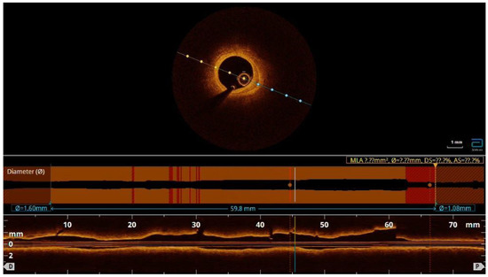 Diagnostics 13 01518 g005