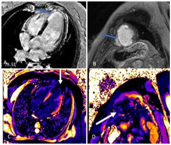 Diagnostics 13 01518 g006
