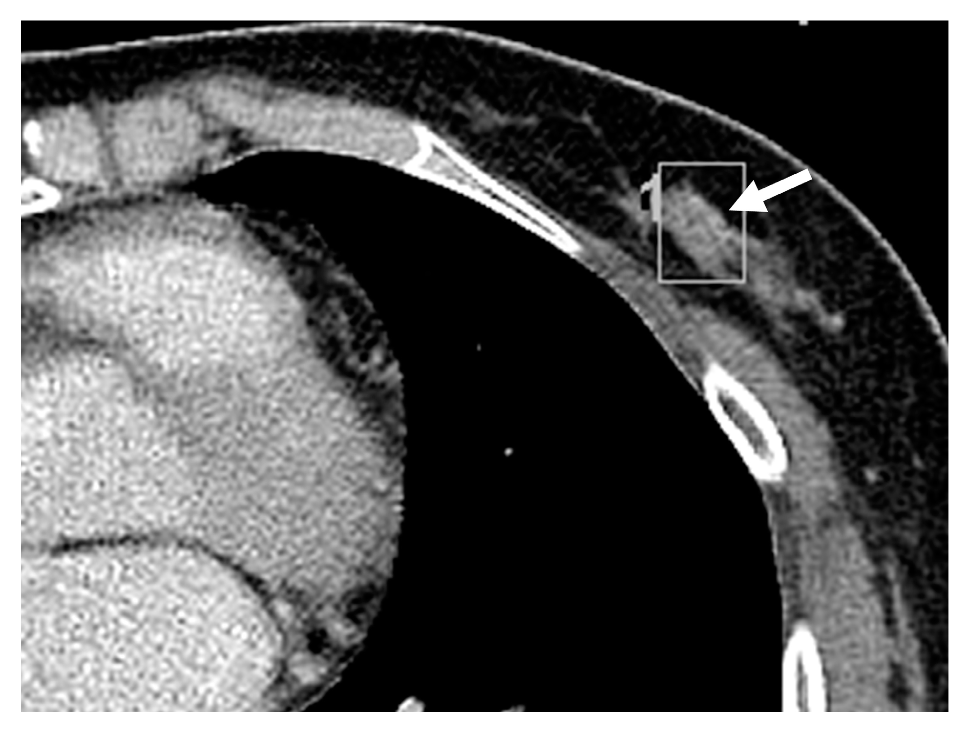 Diagnostics 13 01522 g003