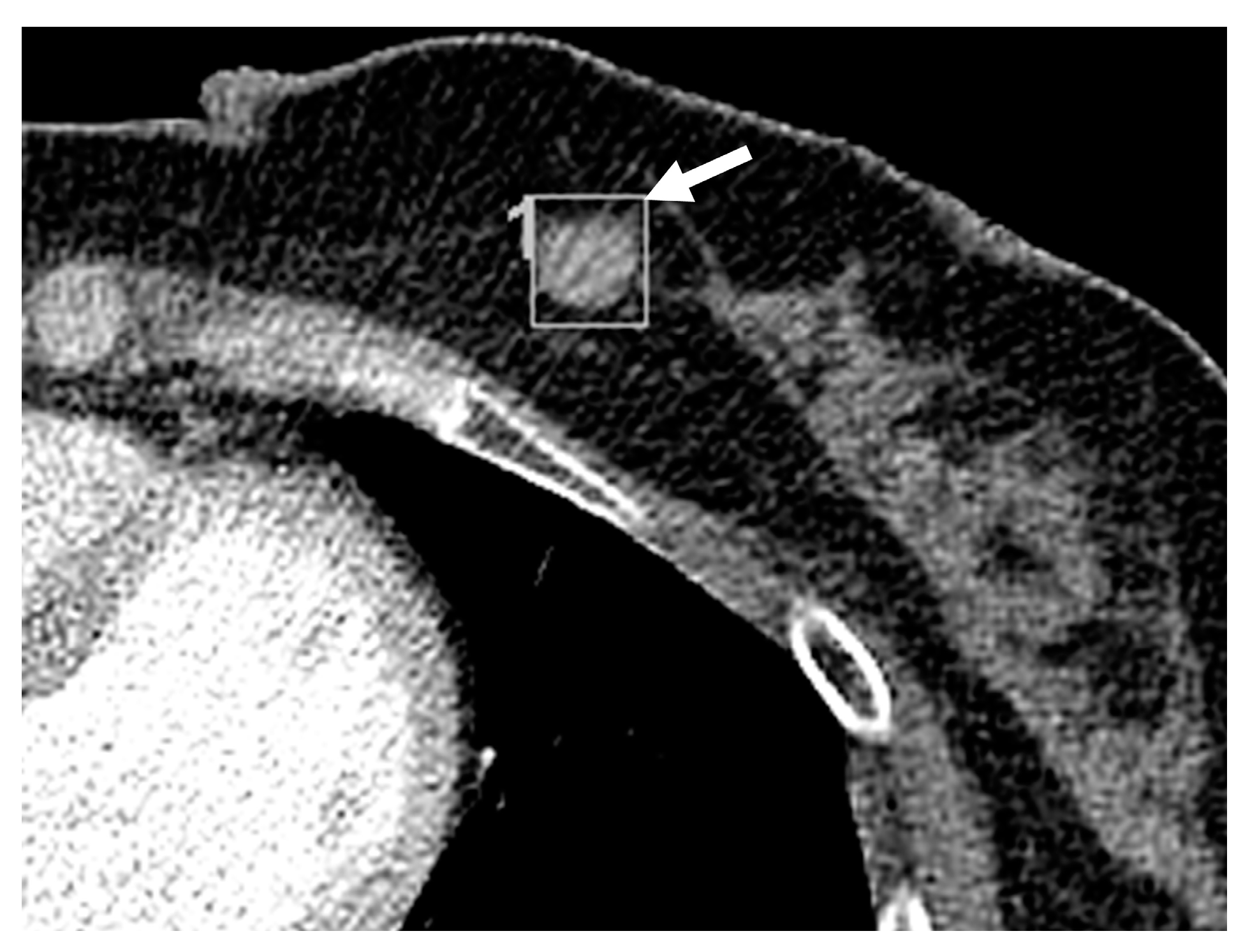 Diagnostics 13 01522 g004