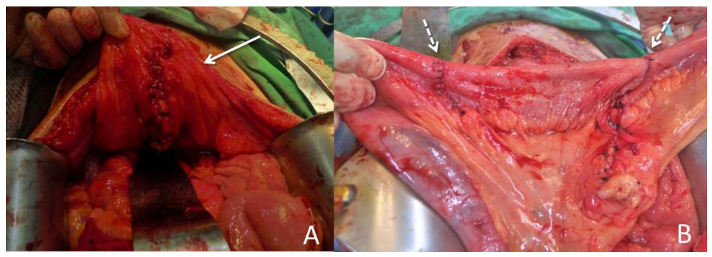 Diagnostics 13 01527 g004
