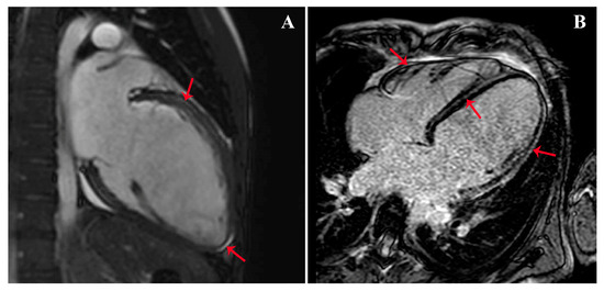 Diagnostics 13 01543 g002