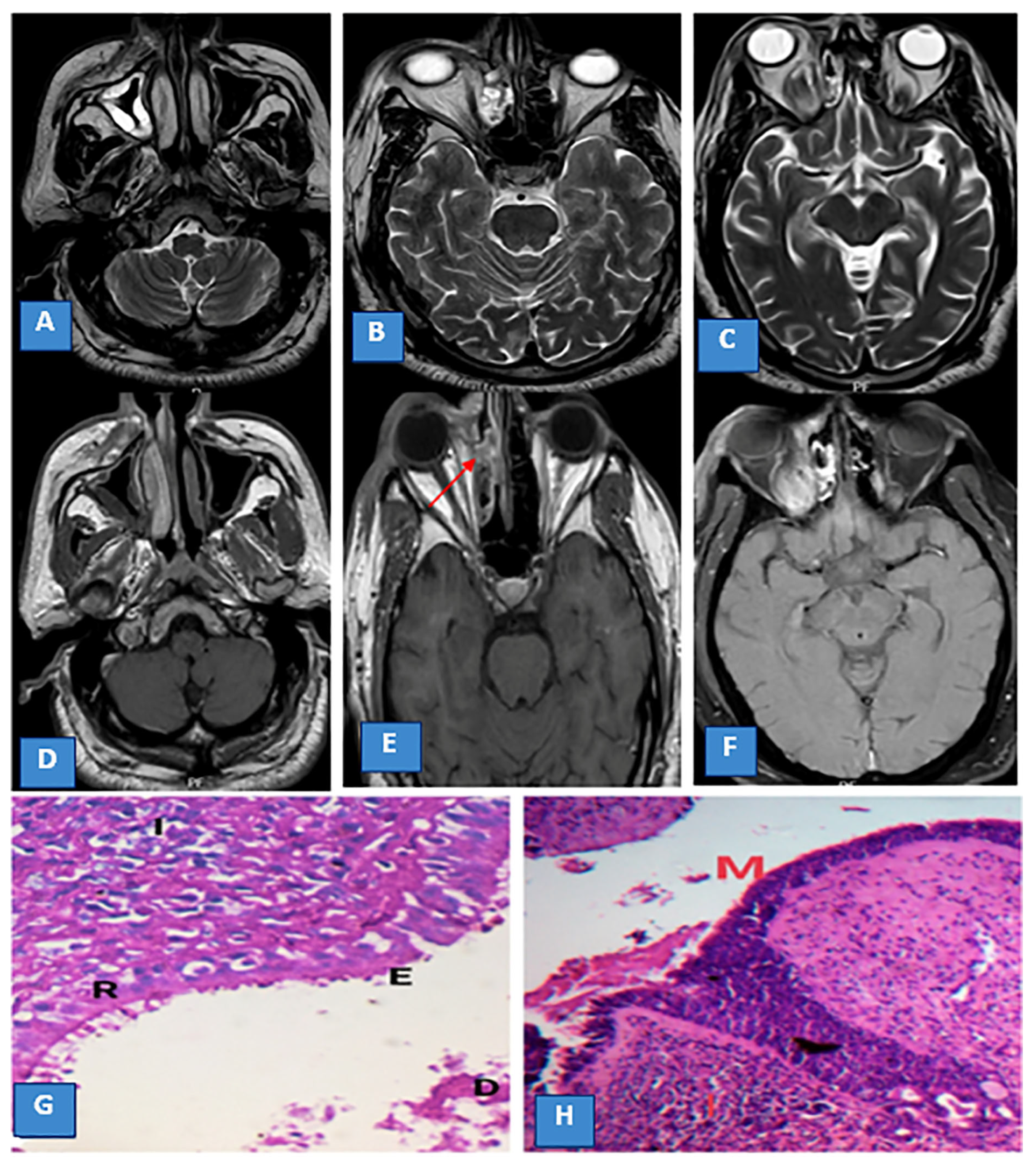 Diagnostics 13 01546 g001
