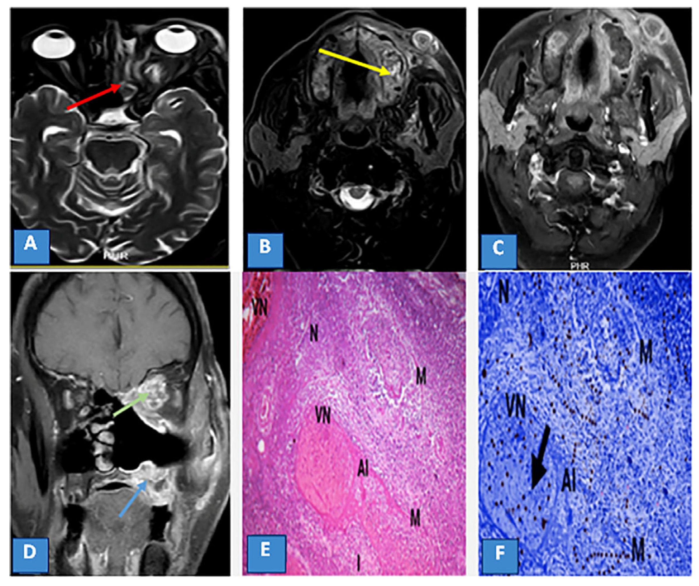 Diagnostics 13 01546 g003