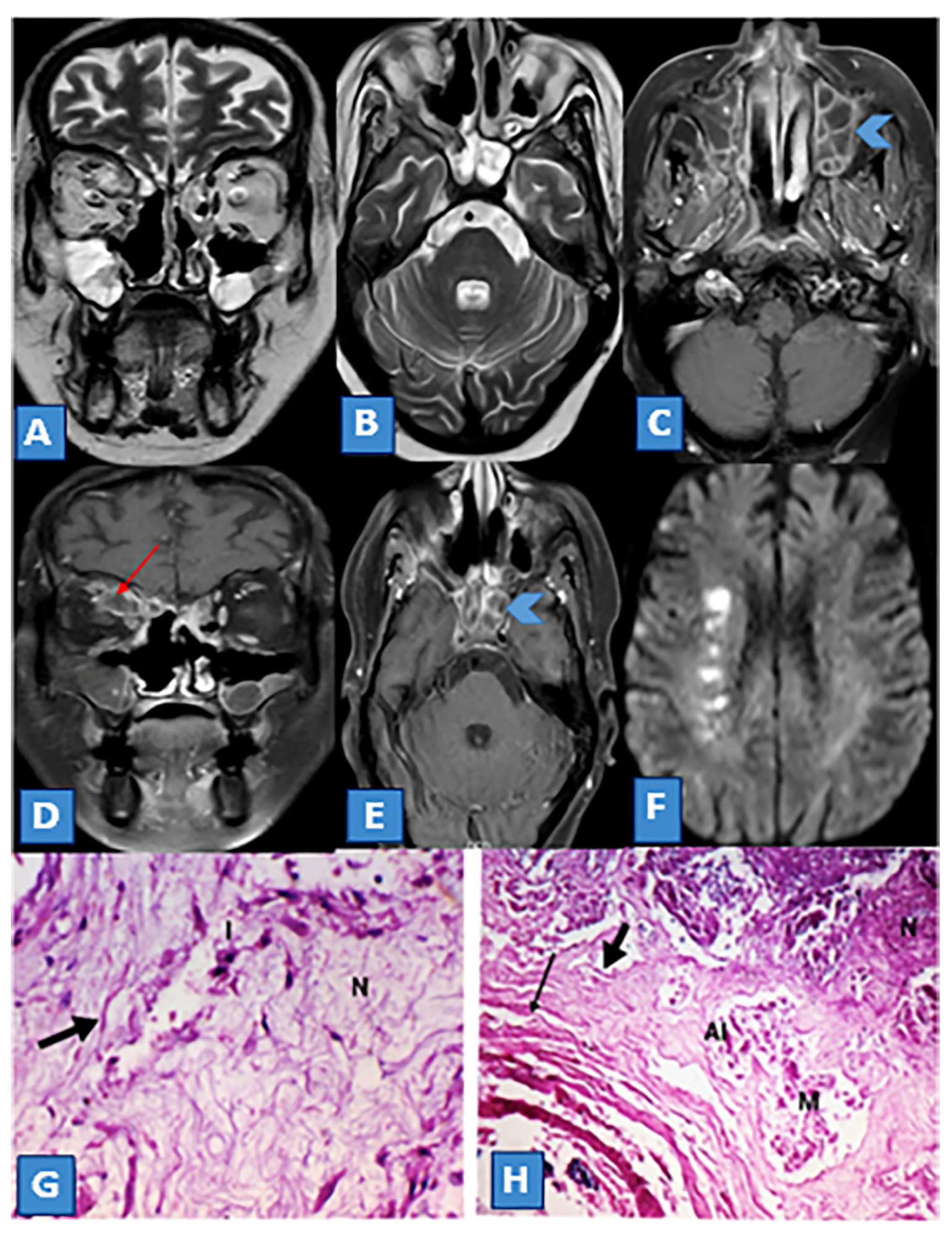 Diagnostics 13 01546 g004