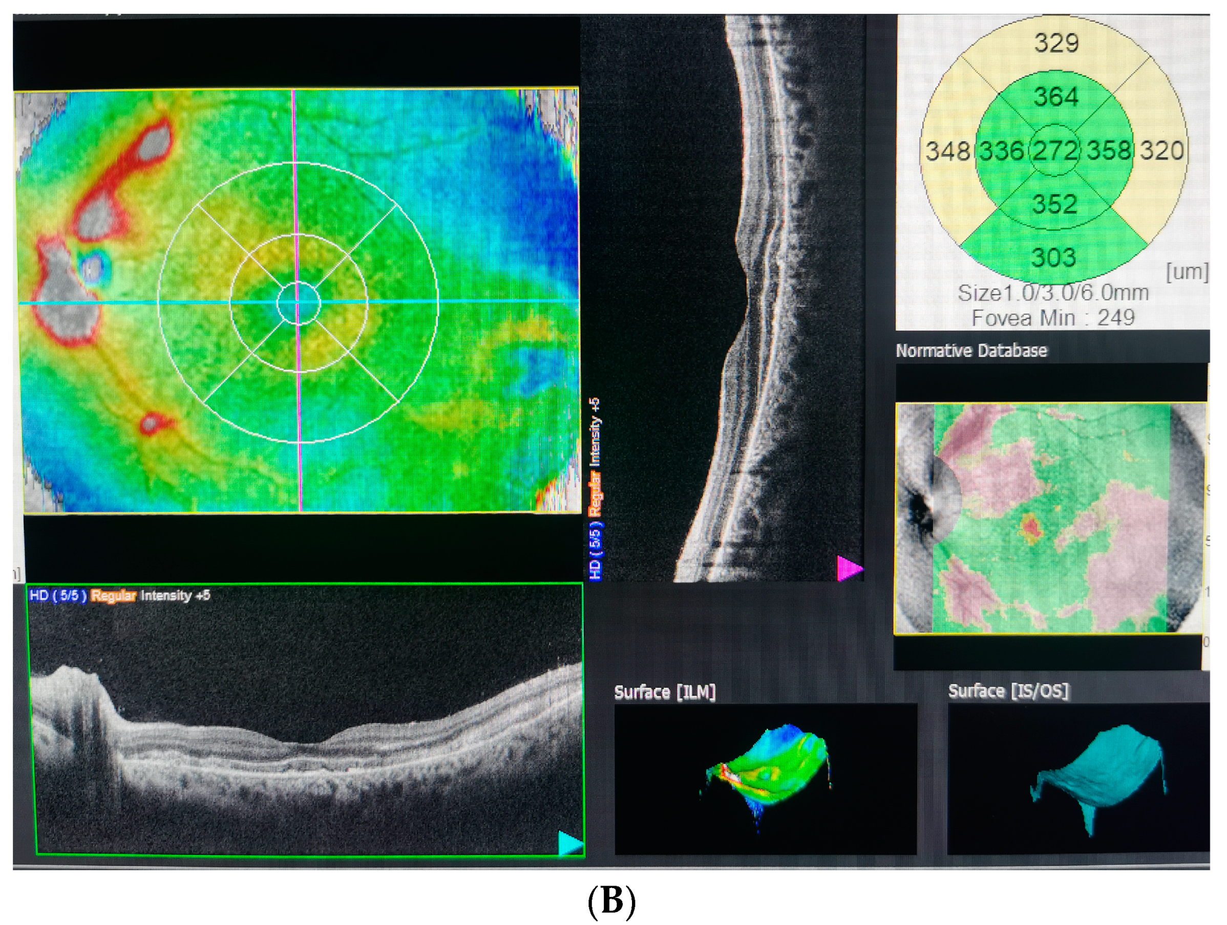 Diagnostics 13 01548 g004b Diagnostics 13 01548 g004b