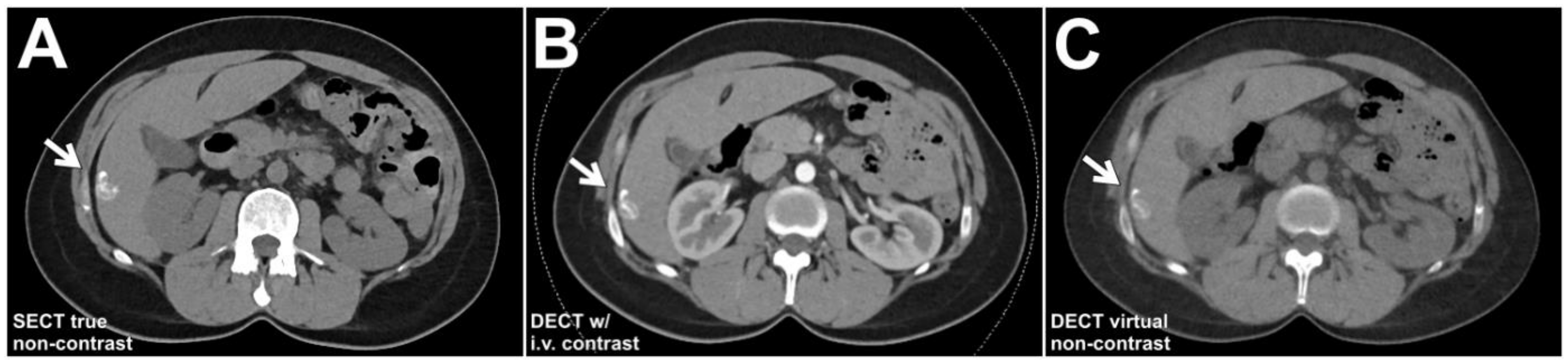Diagnostics 13 01558 g002