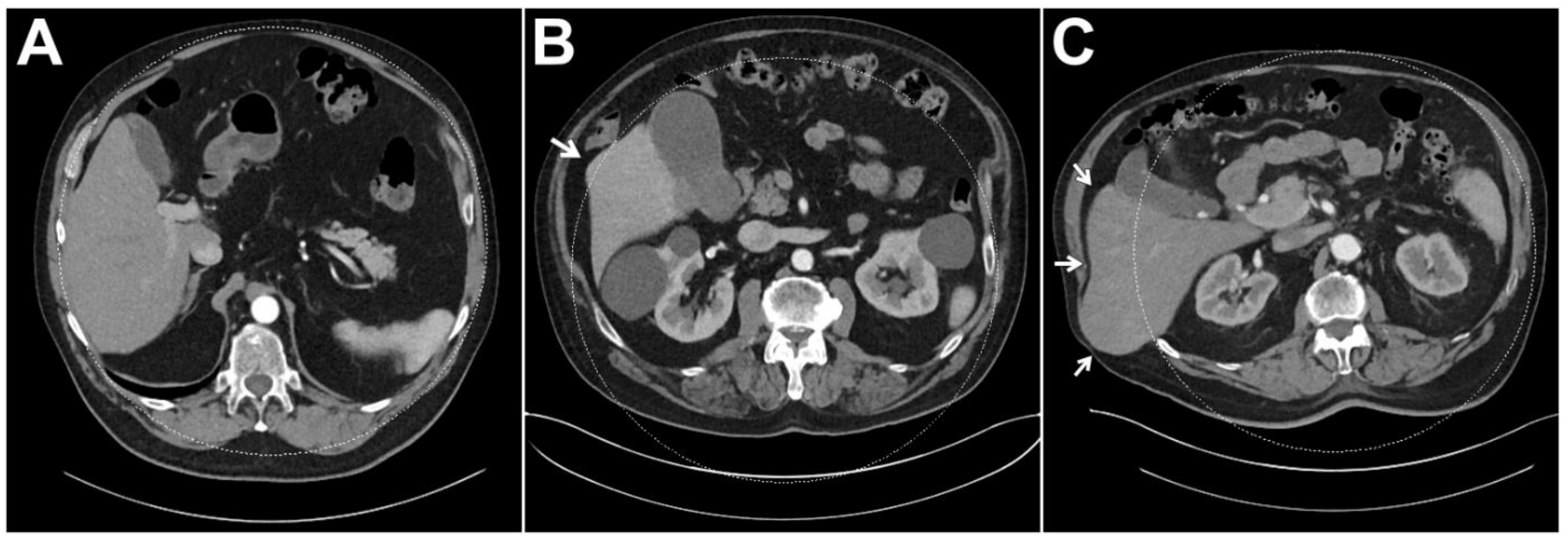 Diagnostics 13 01558 g004