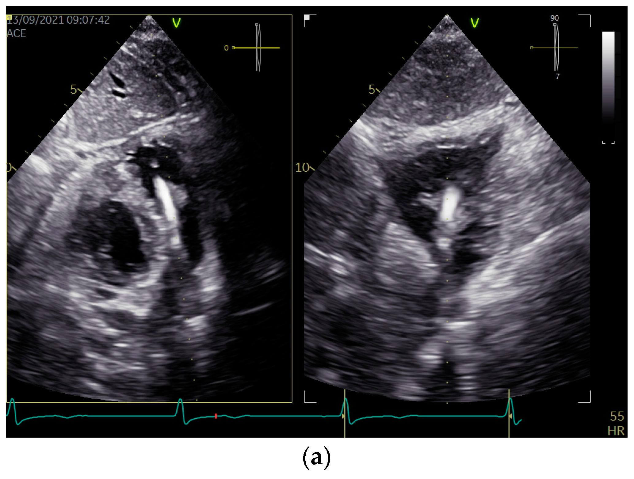 Diagnostics 13 01584 g001a