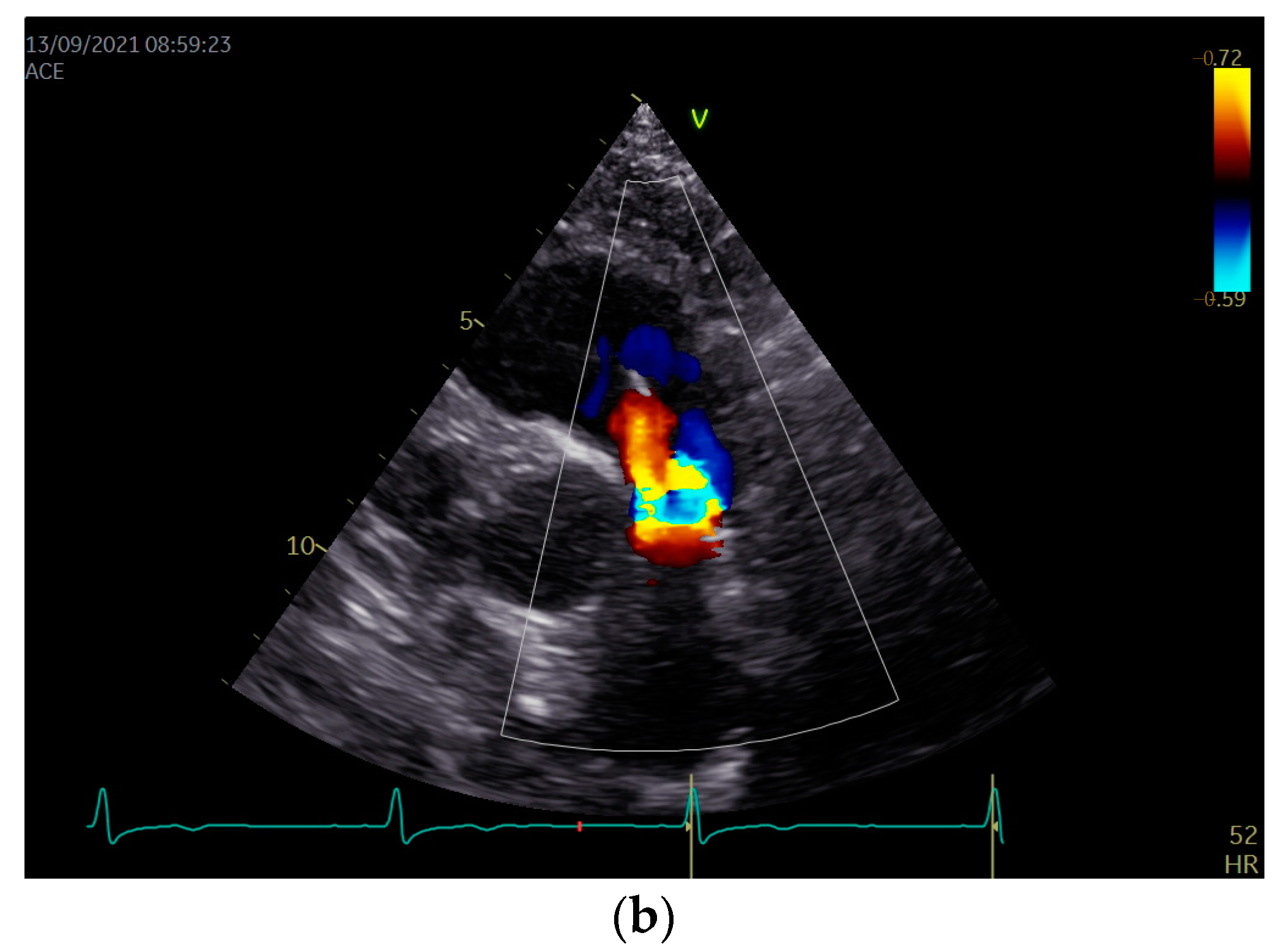 Diagnostics 13 01584 g001b