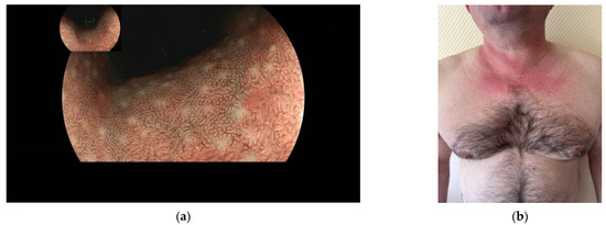 Diagnostics 13 01599 g001