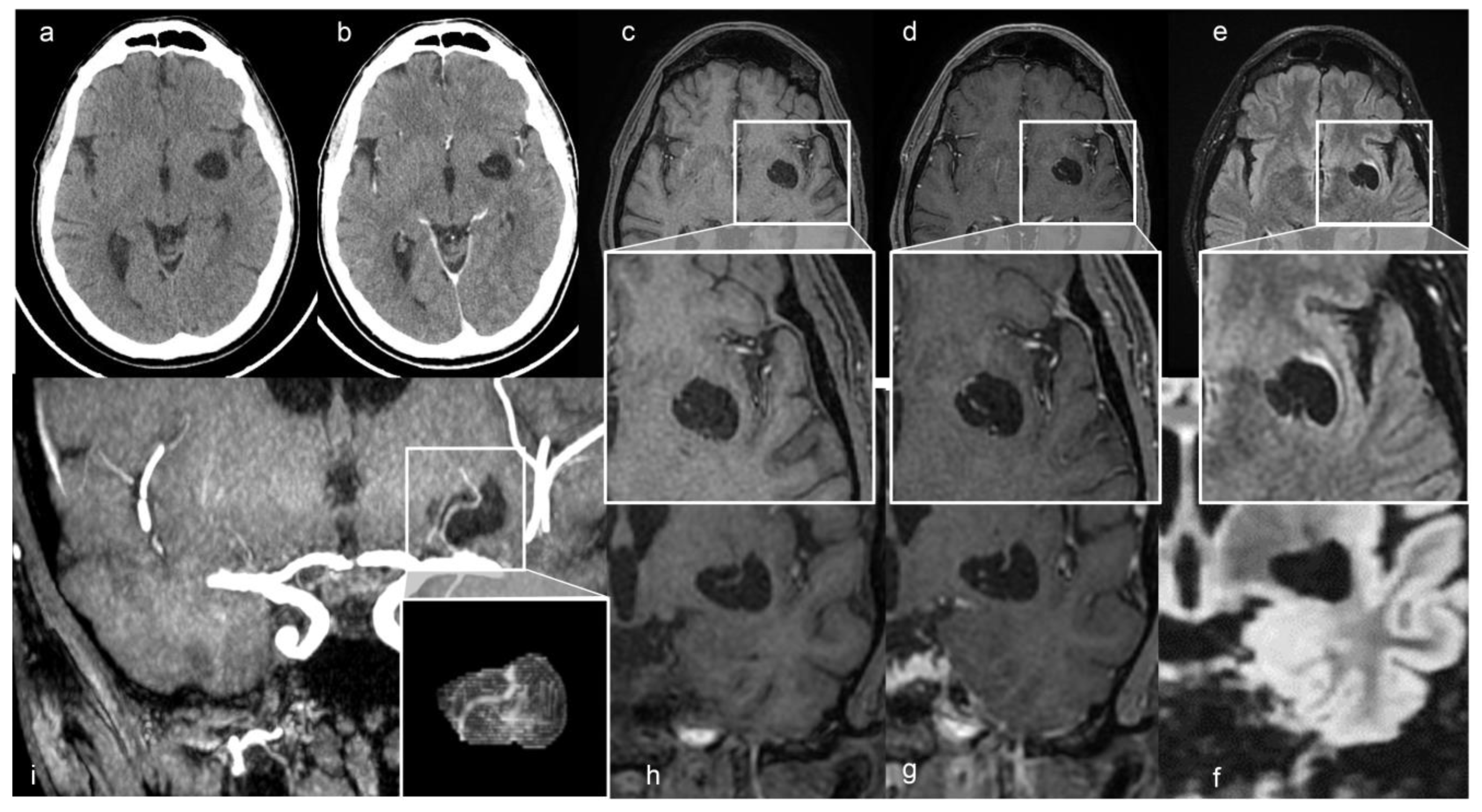 Diagnostics 13 01602 g001