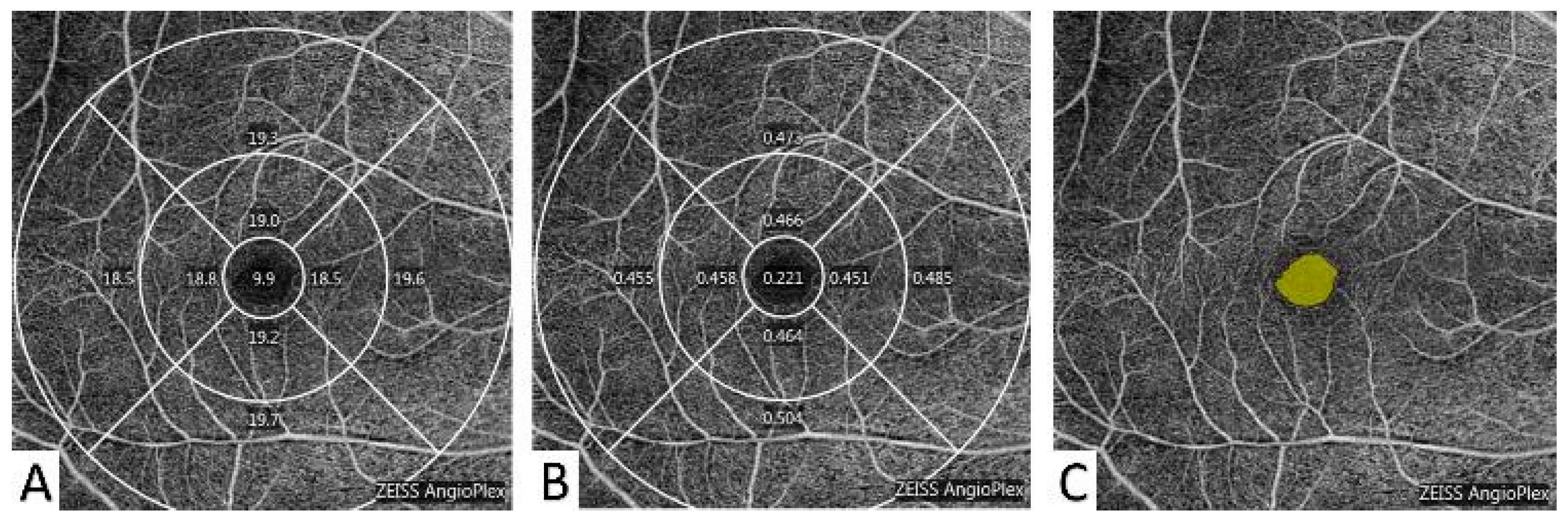 Diagnostics 13 01603 g003 Diagnostics 13 01603 g003